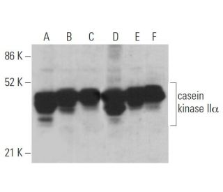 casein kinase II&alpha; Antibody (D-10) - Western Blotting - Image 361032 