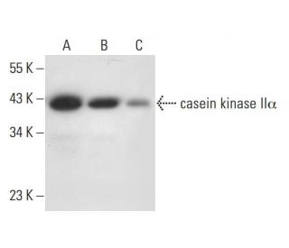casein kinase II&alpha; Antibody (E-2) - Western Blotting - Image 308420 