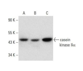 casein kinase II&alpha; Antibody (F-10) - Western Blotting - Image 144808 