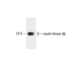 casein kinase II&beta; Antibody (51) - Western Blotting - Image 60256 