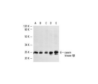 casein kinase II&beta; Antibody (6D5) - Western Blotting - Image 2182 