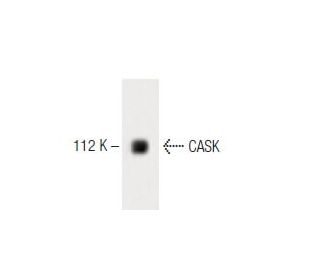 CASK Antibody (7) - Western Blotting - Image 60257
