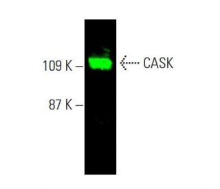 CASK Antibody (C-6) - Western Blotting - Image 385556