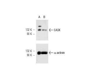 CASK siRNA (h): sc-29920. Western blot analysis of CASK expression in non-transfected control (A) and CASK siRNA transfect 