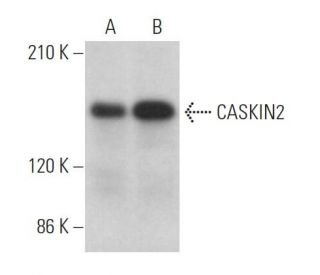 CASKIN2 Antibody (D-9) - Western Blotting - Image 372860 