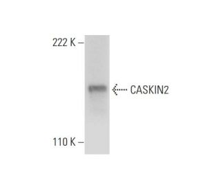 CASKIN2 Antibody (E-10) - Western Blotting - Image 300171 