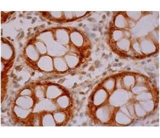 caspase-7 p20 Antibody (B-5) - Immunohistochemistry - Image 286336 