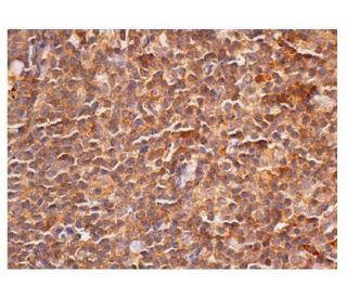 caspase-8 p18 Antibody (G-1) - Immunohistochemistry - Image 352918 