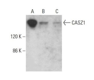 CASZ1 Antibody (B-11) - Western Blotting - Image 382673The Double Nickase Plasmid features a U6 promoter for sgRNA expression, a 20 nt targeting sequence, and a gRNA scaffold to guide Cas9n. It includes a CBh promoter for Cas9n (D10A) and puromycin resistance, GFP for transfection verification, and nuclear localization signals (NLS). The 2A peptide allows co-expression of Cas9n and Puro from a single promoter, enabling precise genome editing with reduced off-target effects.