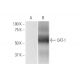 CAT-1 Antibody (2B9) - Western Blotting - Image 347577 