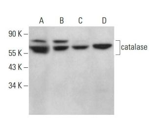catalase Antibody (A-4) - Western Blotting - Image 376062 