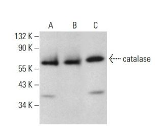 catalase Antibody (E-7) - Western Blotting - Image 376052 