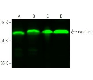catalase Antibody (H-9) - Western Blotting - Image 375641 