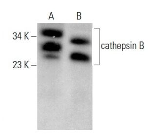 cathepsin B Antibody (H-5) - Western Blotting - Image 379856 