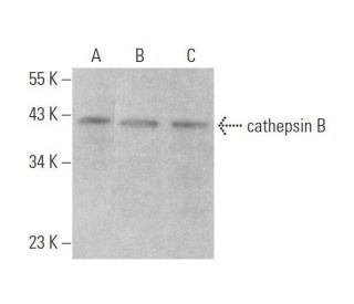 cathepsin B Antibody (H-5) - Western Blotting - Image 353347Each CRISPR/Cas9 Knockout (KO) Plasmid product consists of a pool of 3 plasmids designed to ensure identification and cleavage of a specific gene for maximum knockout efficiency. Each plasmid encodes a unique 20 nt sequence derived from the GeCKO (v2) library.