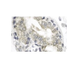cathepsin L Antibody (33/2) - Immunohistochemistry - Image 12100 