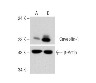 Caveolin-1 CRISPR Activation Plasmid (h): sc-400102-ACT. Western blot analysis of Caveolin-1 expression in non-transfectedSAM Transcription Activation: SAM system utilizing dCas9-VP64, MS2-P65-HSF1, and sgRNA for precise gene transcription activation.