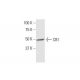 CB1/Cannabinoid Receptor 1/CNR1 Antibody (2F9) - Western Blotting - Image 352105 