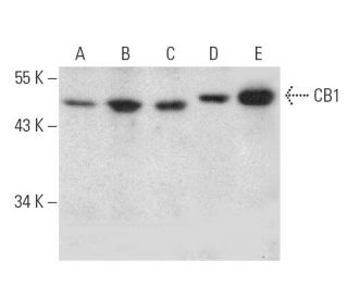 CB1/Cannabinoid Receptor 1/CNR1 Antibody (C-11) - Western Blotting - Image 389152