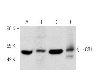 CB1/Cannabinoid Receptor 1/CNR1 Antibody (C-11) - Western Blotting - Image 388982