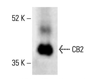 CB2/Cannabinoid Receptor 2/CNR2 Antibody (B-6) - Western Blotting - Image 411989The Double Nickase Plasmid features a U6 promoter for sgRNA expression, a 20 nt targeting sequence, and a gRNA scaffold to guide Cas9n. It includes a CBh promoter for Cas9n (D10A) and puromycin resistance, GFP for transfection verification, and nuclear localization signals (NLS). The 2A peptide allows co-expression of Cas9n and Puro from a single promoter, enabling precise genome editing with reduced off-target effects.