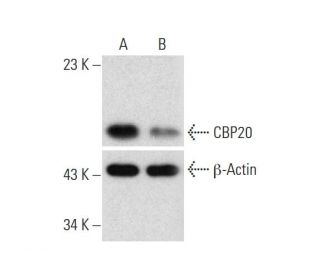 CBP20 Double Nickase Plasmid (h): sc-404124-NIC. Western blot analysis of CBP20 expression in non-transfected control (A) 
