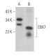 CBX7 Antibody (G-3) - Western Blotting - Image 363962 