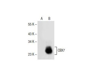 CBX7 Antibody (G-3) - Western Blotting - Image 154943Each CRISPR/Cas9 Knockout (KO) Plasmid product consists of a pool of 3 plasmids designed to ensure identification and cleavage of a specific gene for maximum knockout efficiency. Each plasmid encodes a unique 20 nt sequence derived from the GeCKO (v2) library.