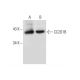 CC2D1B Antibody (F-5) - Western Blotting - Image 136245 