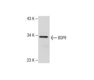 BSPII (H-157): sc-292393. Western blot analysis of BSPII expression in CCD-1064Sk whole cell lysate. 
