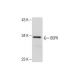 BSPII (H-157): sc-292393. Western blot analysis of BSPII expression in CCD-1064Sk whole cell lysate. 