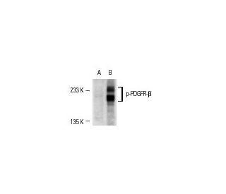 CCD-1064Sk + PDGF Cell Lysate: sc-2264. Western blot analysis of... 