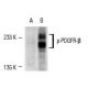 CCD-1064Sk + PDGF Cell Lysate: sc-2264. Western blot analysis of... 