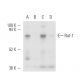 CCD-1064Sk + PDGF Cell Lysate: sc-2264. Western blot analysis of...