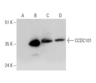 CCDC101 Antibody (D-1) - Western Blotting - Image 344702