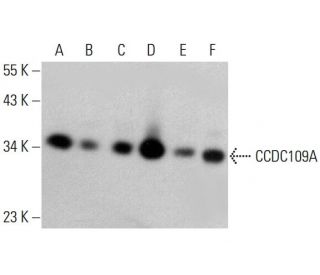 CCDC109A Antibody (E-9) - Western Blotting - Image 381015SAM Transcription Activation: SAM system utilizing dCas9-VP64, MS2-P65-HSF1, and sgRNA for precise gene transcription activation.
