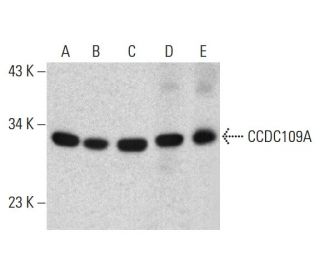 CCDC109A Antibody (E-9) - Western Blotting - Image 385720Each CRISPR/Cas9 Knockout (KO) Plasmid product consists of a pool of 3 plasmids designed to ensure identification and cleavage of a specific gene for maximum knockout efficiency. Each plasmid encodes a unique 20 nt sequence derived from the GeCKO (v2) library.