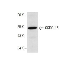 CCDC116 Antibody (G-5) - Western Blotting - Image 323781