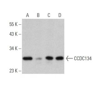 CCDC134 Antibody (B-8) - Western Blotting - Image 333444 