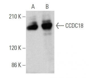 CCDC18 Antibody (G-5) - Western Blotting - Image 370136 