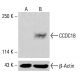 eIF4H (C-6):sc-515265。通过蛋白质印迹分析 K-562 完整细胞裂解物中的 eIF4H 表达。使用的检测试剂:m-IgG Fc BP-HRP:sc-525409。 CCDC18 Antibody (G-5) - Western Blotting - Image 415981