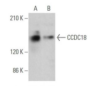 CCDC18 Antibody (H-2) - Western Blotting - Image 370135 