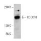 CCDC18 Antibody (H-2) - Western Blotting - Image 370138