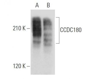 CCDC180 Antibody (G-10) - Western Blotting - Image 303794 