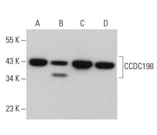 CCDC198 Antibody (G-3) - Western Blotting - Image 373230 