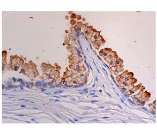 CCDC33 Antibody (F-3) - Immunohistochemistry - Image 287283 