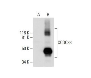 CCDC33 Antibody (H-2) - Western Blotting - Image 291994 