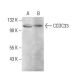 CCDC33 Antibody (H-2) - Western Blotting - Image 379089