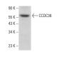 CCDC36 Antibody (B-11) - Western Blotting - Image 378175