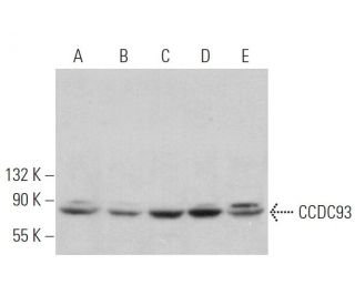 CCDC93 Antibody (H-11) - Western Blotting - Image 375972 